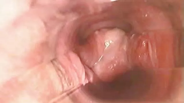 医者はママを唐辛子に熱く入れた。 女 用 エロ 動画 無料